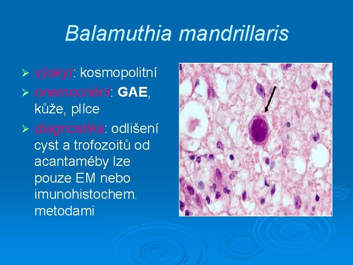 Balamuthia mandrillaris výskyt: kosmopolitní Ø onemocnění: GAE, kůže, plíce Ø diagnostika: odlišení cyst a