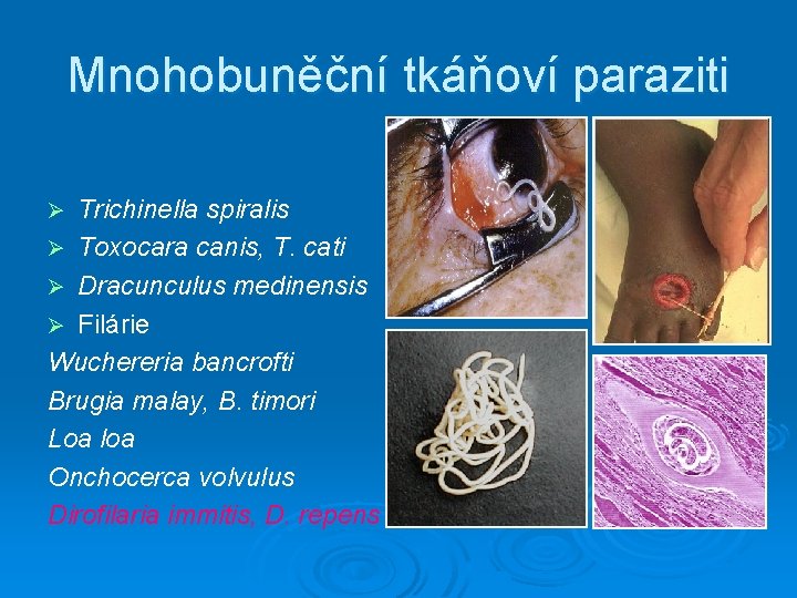 Mnohobuněční tkáňoví paraziti Trichinella spiralis Ø Toxocara canis, T. cati Ø Dracunculus medinensis Ø