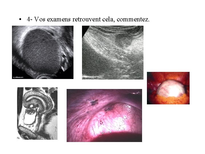  • 4 - Vos examens retrouvent cela, commentez. 