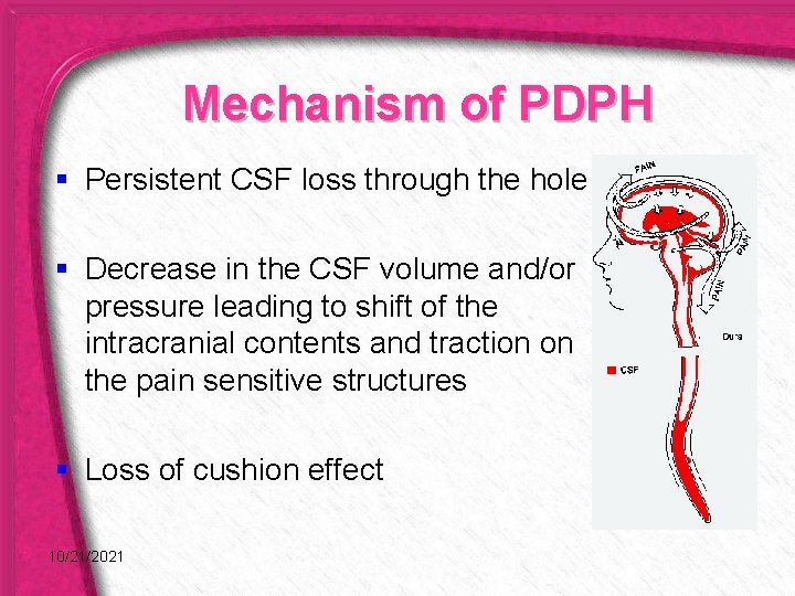 Mechanism of PDPH § Persistent CSF loss through the hole § Decrease in the