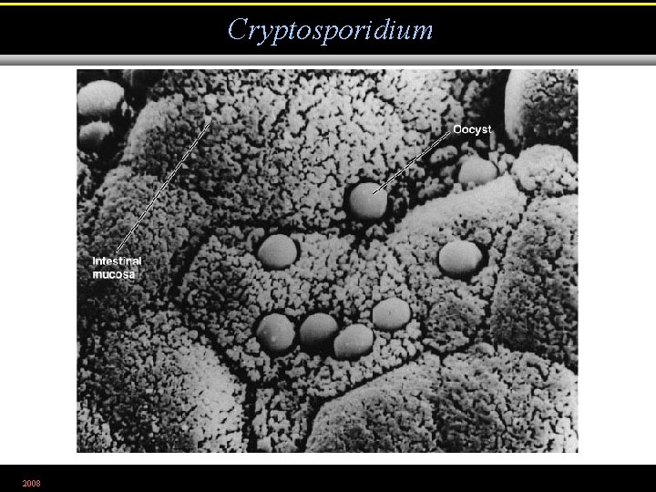 Cryptosporidium 2008 Figure 25. 19 