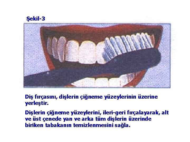 Şekil-3 Diş fırçasını, dişlerin çiğneme yüzeylerinin üzerine yerleştir. Dişlerin çiğneme yüzeylerini, ileri-geri fırçalayarak, alt