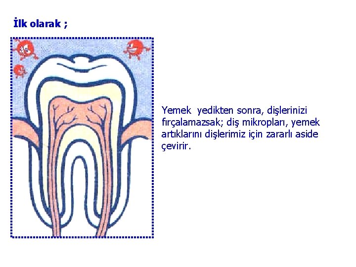 İlk olarak ; Yemek yedikten sonra, dişlerinizi fırçalamazsak; diş mikropları, yemek artıklarını dişlerimiz için