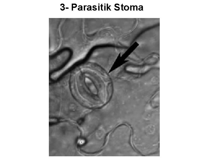 3 - Parasitik Stoma 