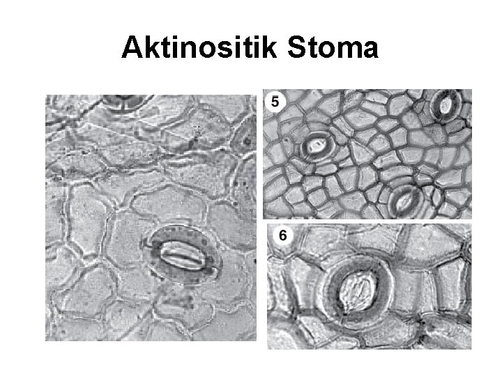 Aktinositik Stoma 