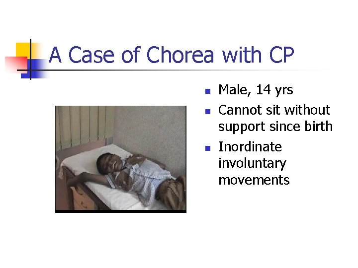 A Case of Chorea with CP n n n Male, 14 yrs Cannot sit