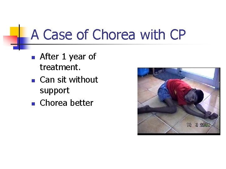 A Case of Chorea with CP n n n After 1 year of treatment.