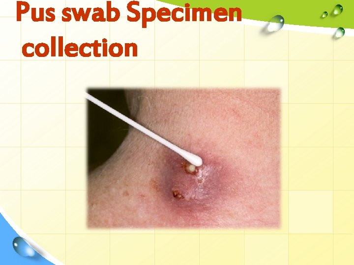 Pus swab Specimen collection 