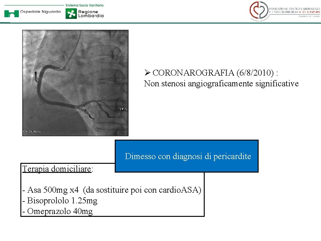 Ø CORONAROGRAFIA (6/8/2010) : Non stenosi angiograficamente significative Dimesso con diagnosi di pericardite Terapia
