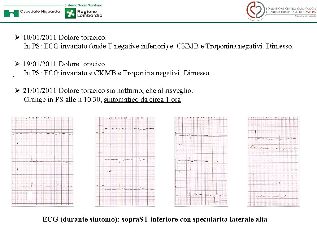 Ø 10/01/2011 Dolore toracico. In PS: ECG invariato (onde T negative inferiori) e CKMB