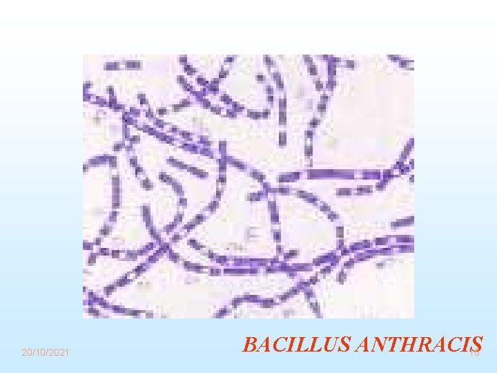 20/10/2021 BACILLUS ANTHRACIS 10 