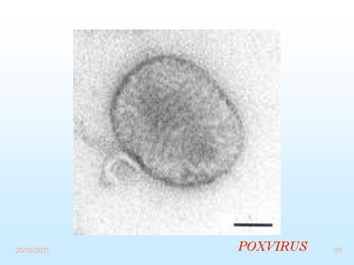 20/10/2021 POXVIRUS 39 