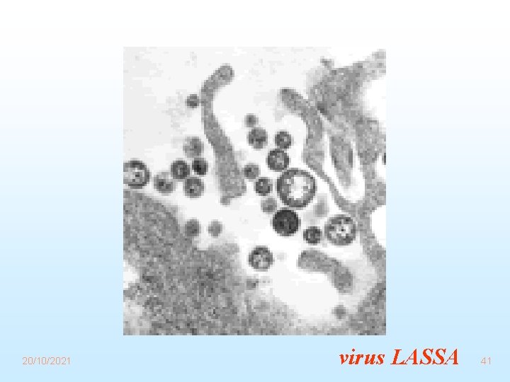 20/10/2021 virus LASSA 41 