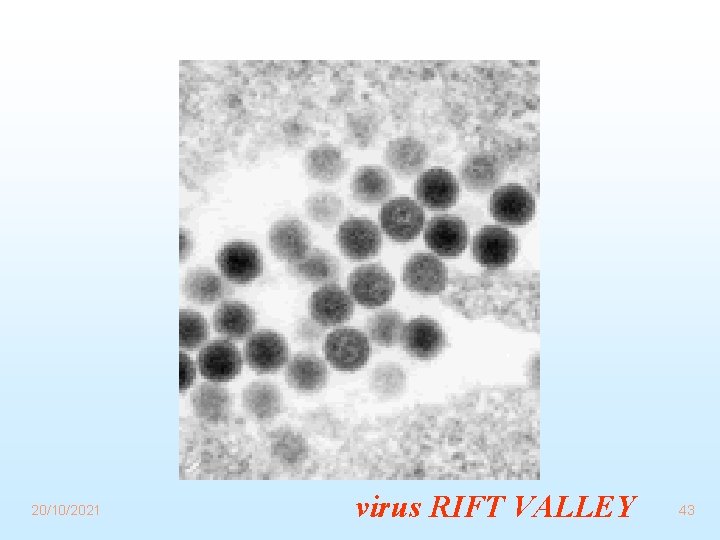 20/10/2021 virus RIFT VALLEY 43 