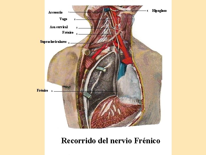 Accesorio Hipogloso Vago Asa cervical Frénico Supraclaviculares Frénico Recorrido del nervio Frénico 