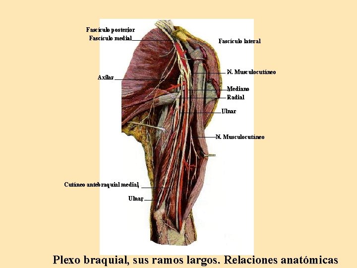 Fascículo posterior Fascículo medial Fascículo lateral N. Musculocutáneo Axilar Mediano Radial Ulnar N. Musculocutáneo