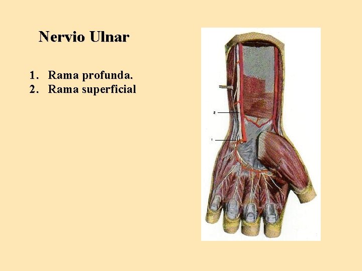 Nervio Ulnar 1. Rama profunda. 2. Rama superficial 