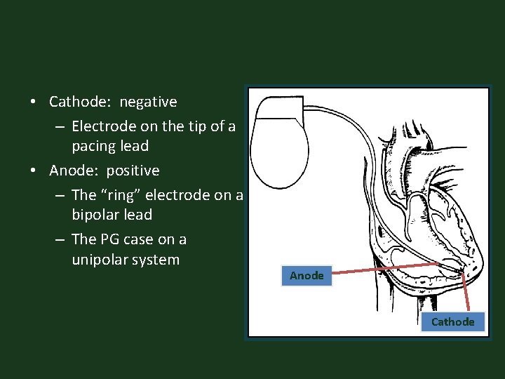  • Cathode: negative – Electrode on the tip of a pacing lead •