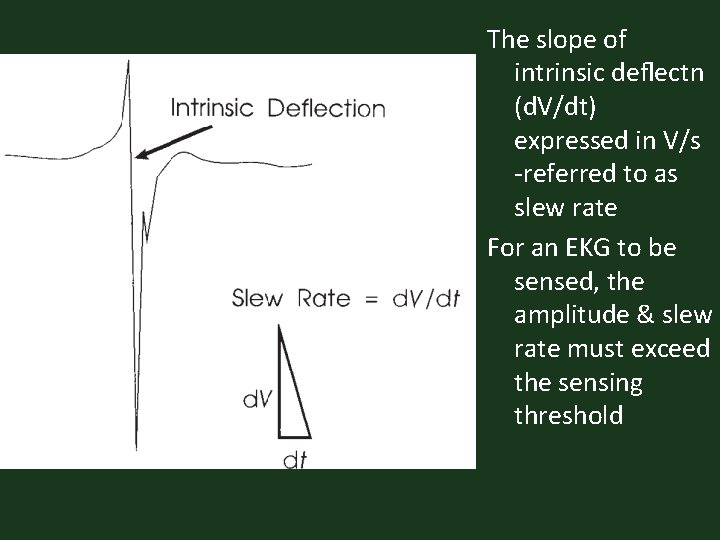 The slope of intrinsic deﬂectn (d. V/dt) expressed in V/s -referred to as slew
