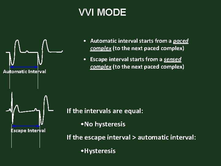 VVI MODE • Automatic interval starts from a paced complex (to the next paced