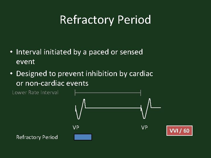 Refractory Period • Interval initiated by a paced or sensed event • Designed to
