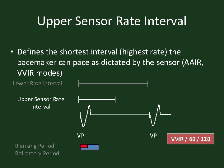 Upper Sensor Rate Interval • Defines the shortest interval (highest rate) the pacemaker can