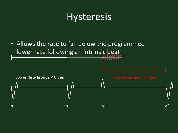 Hysteresis • Allows the rate to fall below the programmed lower rate following an