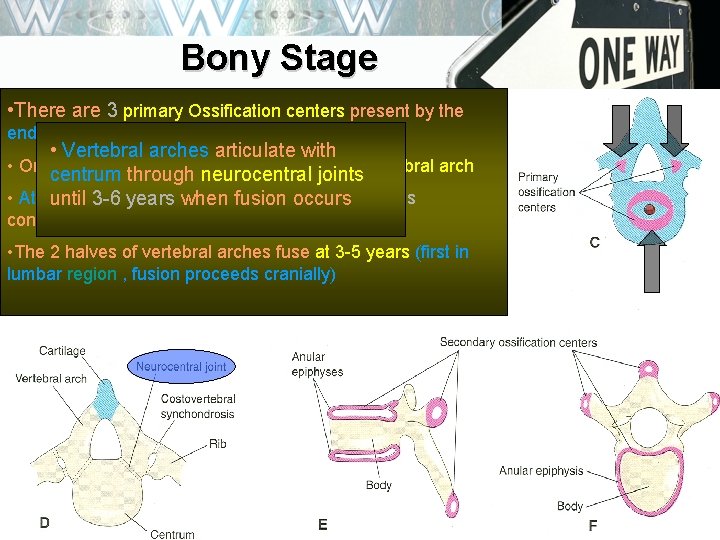 Bony Stage • There are 3 primary Ossification centers present by the end of