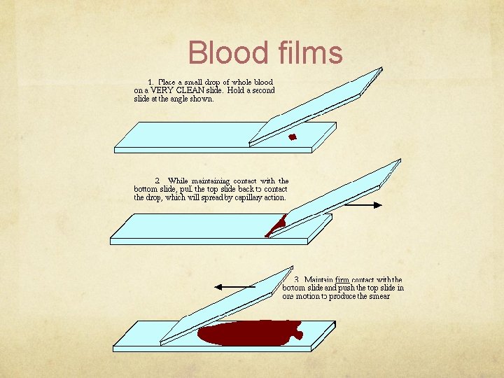 Blood films 