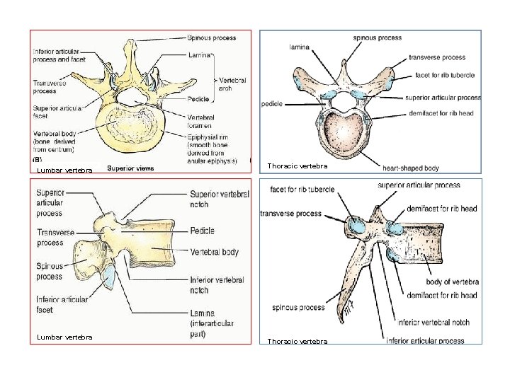 Lumbar vertebra Thoracic vertebra 