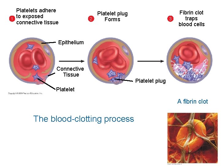 1 Platelets adhere to exposed connective tissue 2 Platelet plug Forms 3 Fibrin clot