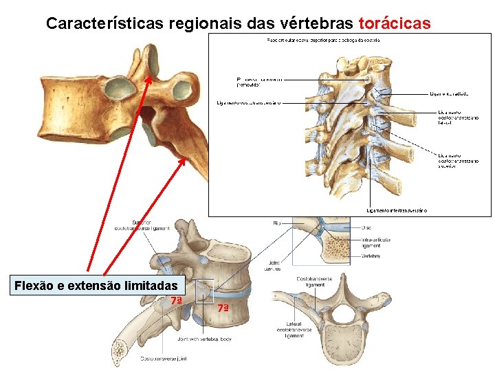 Características regionais das vértebras torácicas Flexão e extensão limitadas 7ª 7ª 