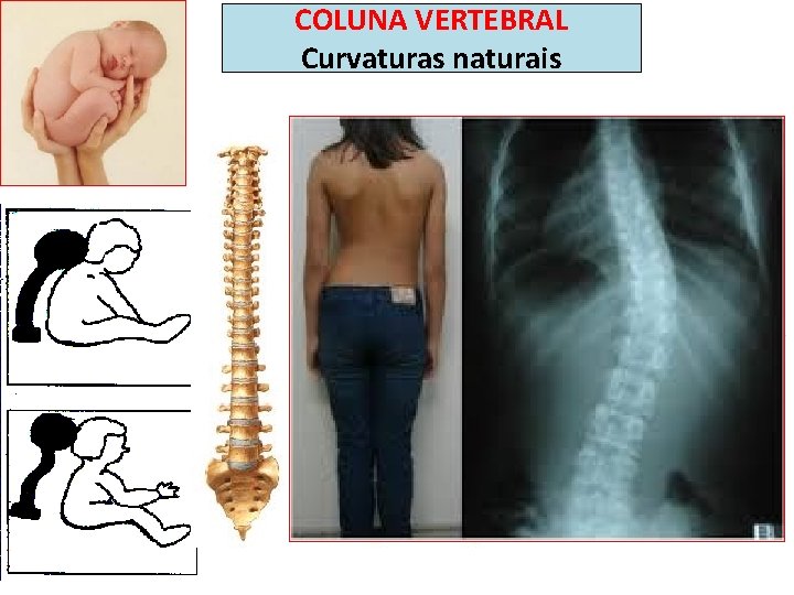 COLUNA VERTEBRAL Curvaturas naturais Lordose C Cifose T Lordose L Cifose SCo 