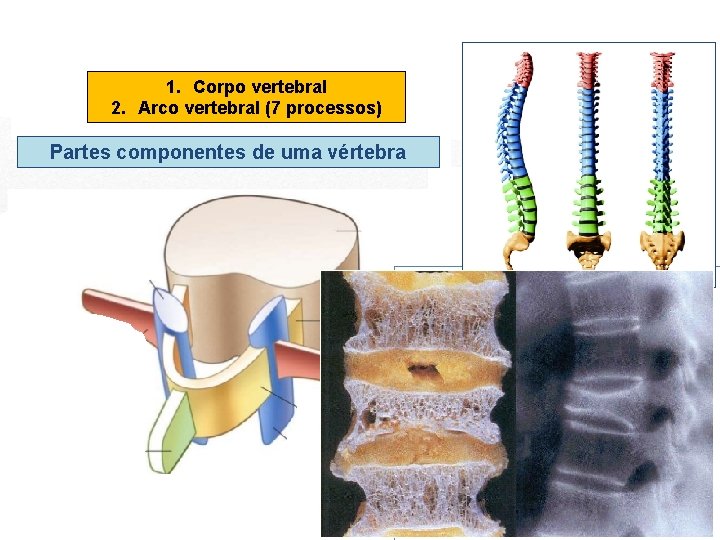 1. Corpo vertebral 2. Arco vertebral (7 processos) Partes componentes de uma vértebra 