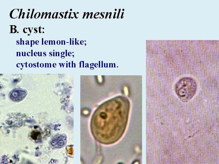 Chilomastix mesnili B. cyst: shape lemon-like; nucleus single; cytostome with flagellum. 