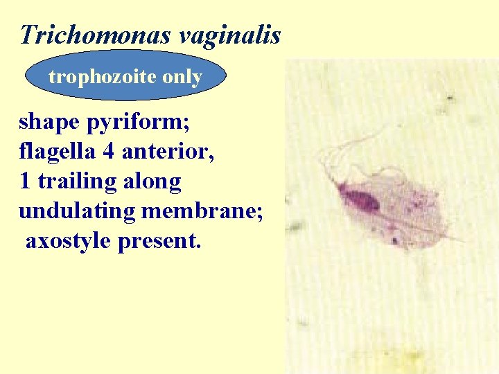 Trichomonas vaginalis trophozoite only shape pyriform; flagella 4 anterior, 1 trailing along undulating membrane;