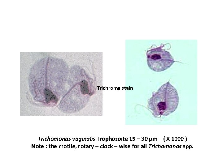 Trichrome stain Trichomonas vaginalis Trophozoite 15 – 30 µm ( X 1000 ) Note