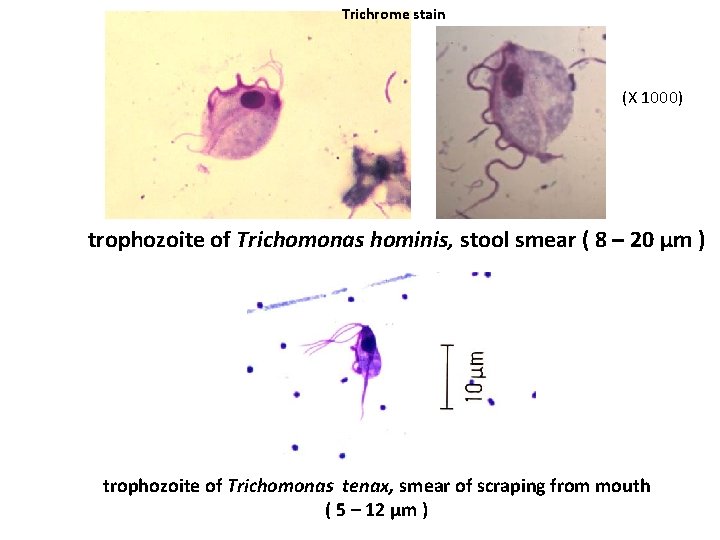 Trichrome stain (X 1000) trophozoite of Trichomonas hominis, stool smear ( 8 – 20