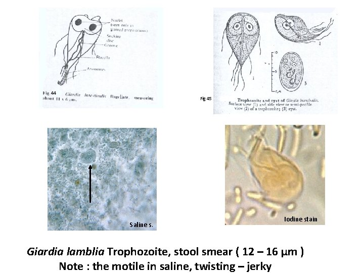 44 Fig 45 Saline s. Iodine stain Giardia lamblia Trophozoite, stool smear ( 12