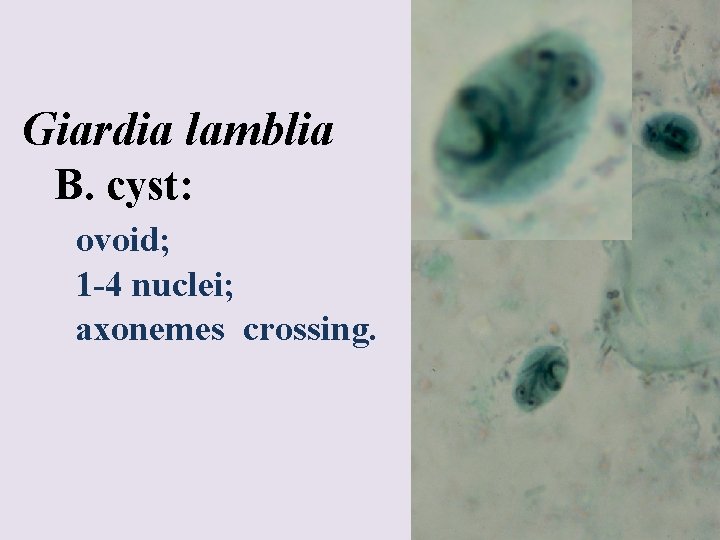 Giardia lamblia B. cyst: ovoid; 1 -4 nuclei; axonemes crossing. 