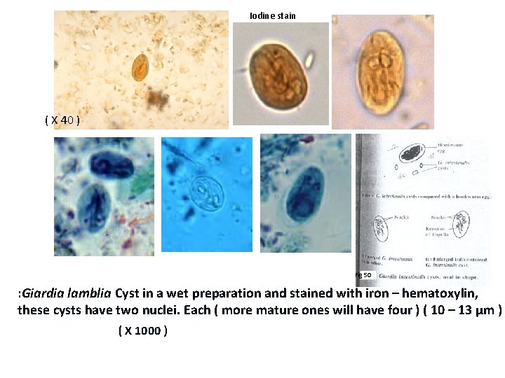 Iodine stain ( X 40 ) Fig 50 : Giardia lamblia Cyst in a