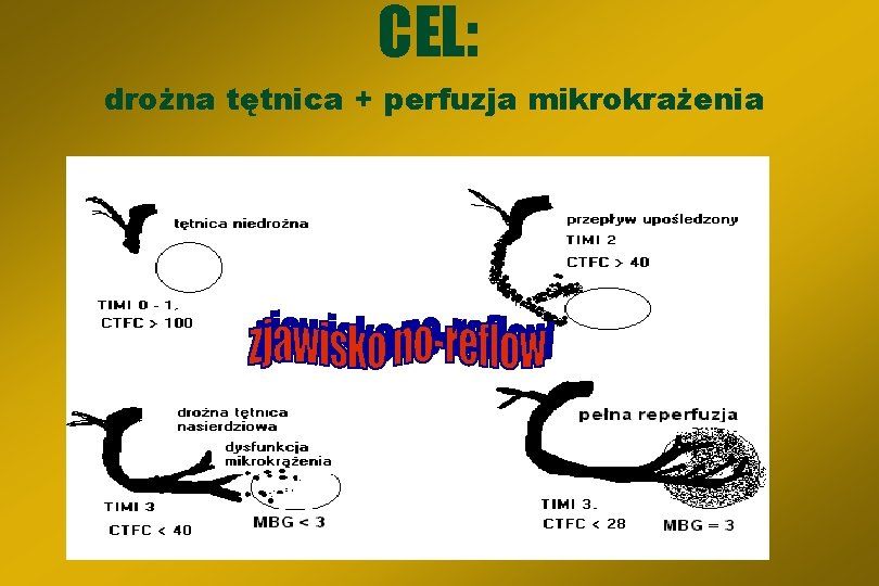 CEL: drożna tętnica + perfuzja mikrokrażenia 