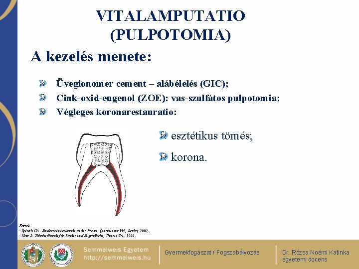 VITALAMPUTATIO (PULPOTOMIA) A kezelés menete: Üvegionomer cement – alábélelés (GIC); Cink-oxid-eugenol (ZOE): vas-szulfátos pulpotomia;