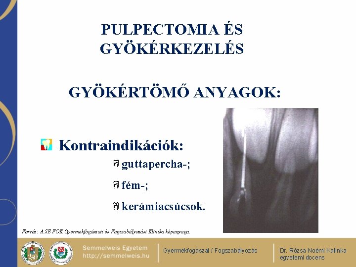 PULPECTOMIA ÉS GYÖKÉRKEZELÉS GYÖKÉRTÖMŐ ANYAGOK: Kontraindikációk: guttapercha-; fém-; kerámiacsúcsok. Forrás: A SE FOK Gyermekfogászati