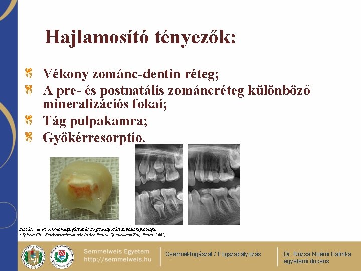 Hajlamosító tényezők: Vékony zománc-dentin réteg; A pre- és postnatális zománcréteg különböző mineralizációs fokai; Tág