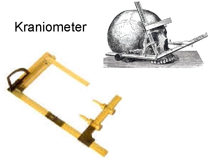 Kraniometer 