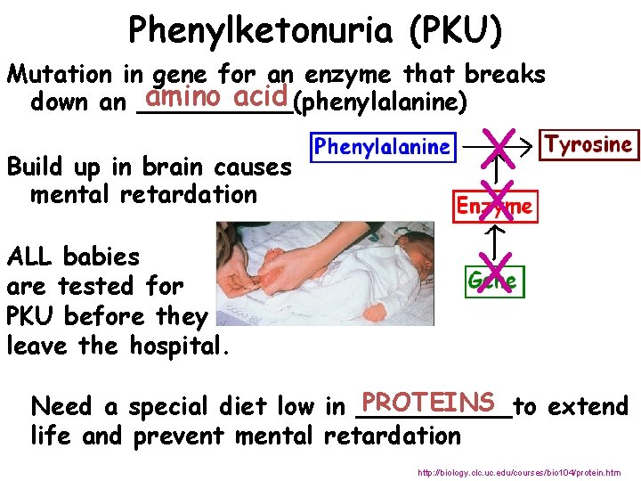 Phenylketonuria (PKU) Mutation in gene for an enzyme that breaks amino acid down an