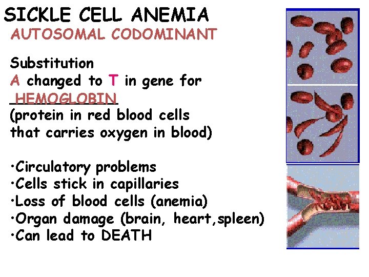 SICKLE CELL ANEMIA AUTOSOMAL CODOMINANT Substitution A changed to T in gene for ______