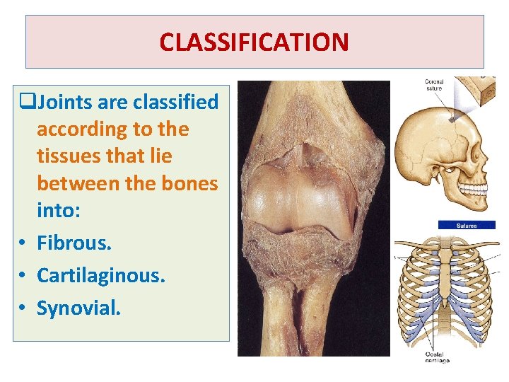 CLASSIFICATION q. Joints are classified according to the tissues that lie between the bones