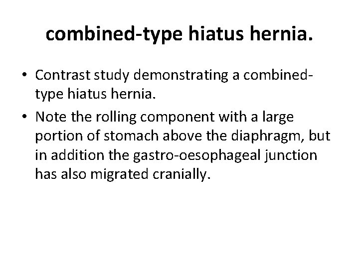 combined-type hiatus hernia. • Contrast study demonstrating a combinedtype hiatus hernia. • Note the